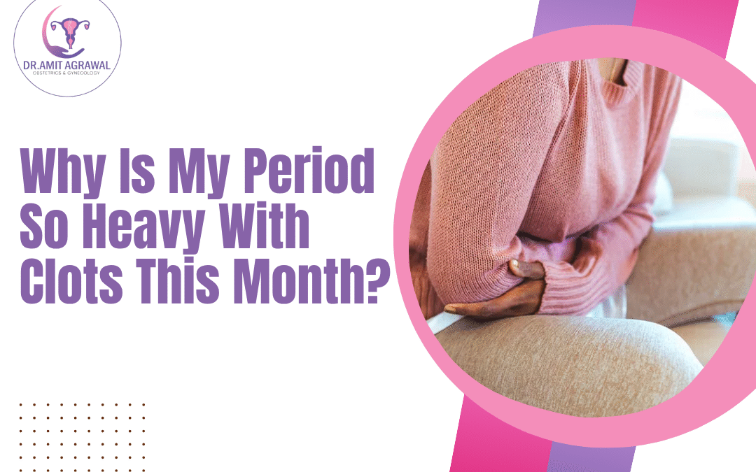 Why Is My Period So Heavy With Clots This Month?