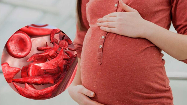 Complications of Anemia in Pregnancy